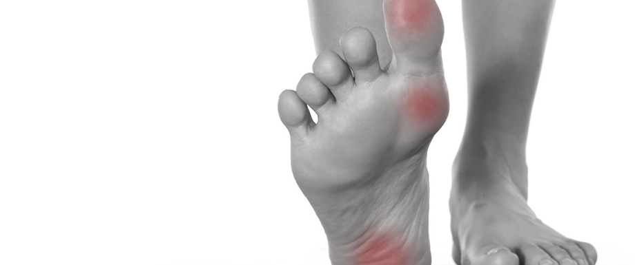 	
Diabetes and feet – Foot corn diagnosis